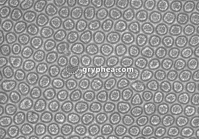 Microvillosités intestinales CT MET x35000 - gryphea.com